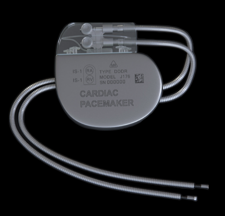 Pacemaker